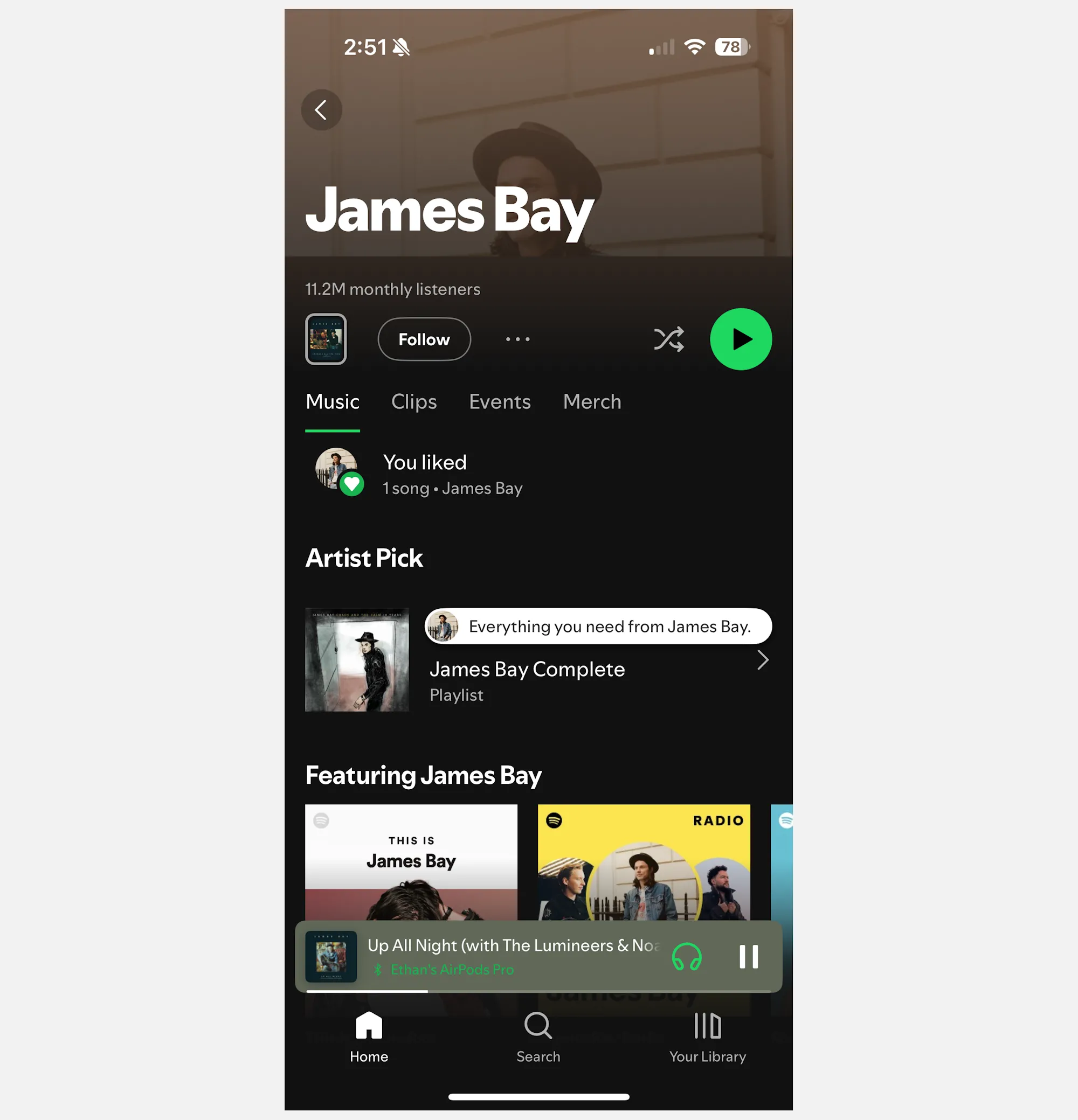 Lỗi Spotify không hiển thị album trên trang nghệ sĩ